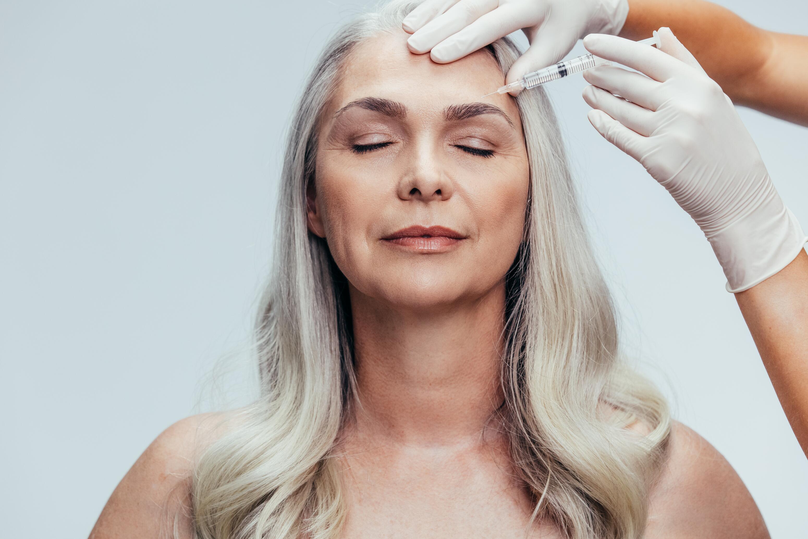Eine Frau erhält eine Injektion in die Stirn während einer Botox-Behandlung, um mimische Falten zu glätten.
